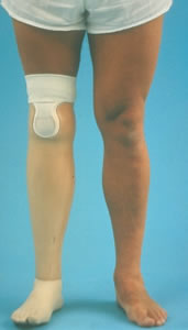 transtibial-suspension05